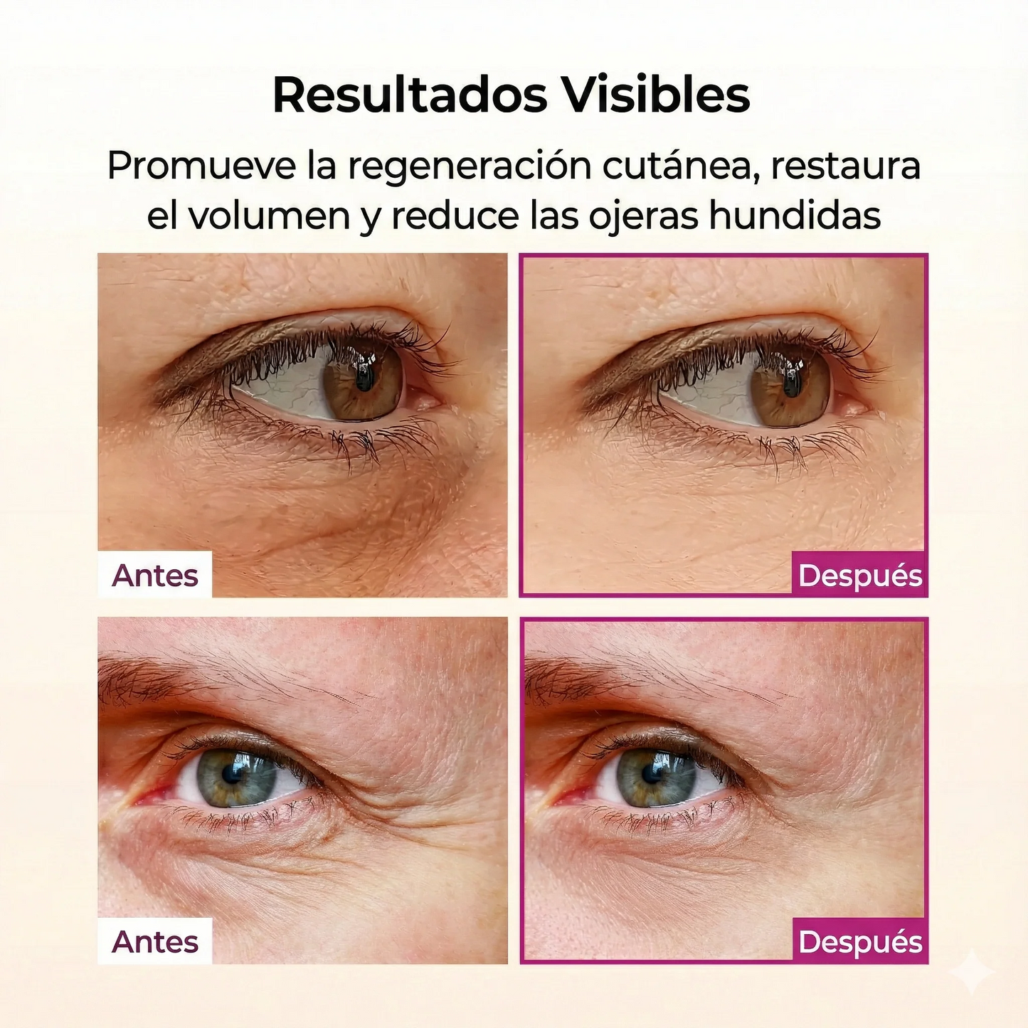Bálsamo Facial Reafirmante - Elimina Arrugas y Líneas de Expresión